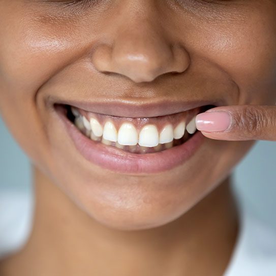 full mouth reconstruction cosmetic dentist huntsville
